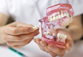 Hands holding sample implants and dental bridge