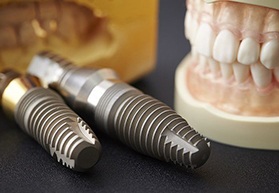 dental implant posts lying on a table next to a set of false teeth