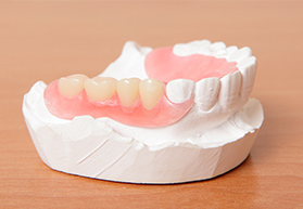 partial denture