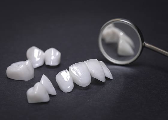 metal free crowns