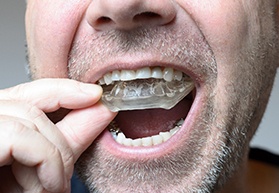 Bearded man putting in a mouthguard for bruxism