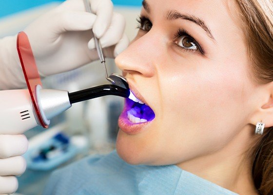 dental sealants