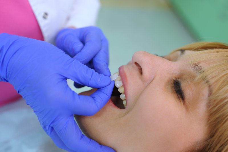 Smiling patient being fit for veneers