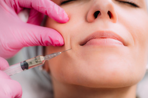 Close-up of patient receiving dermal fillers for laugh lines