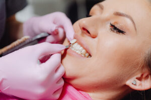 Dentist replacing a woman’s veneer