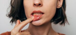Woman with gum disease. 