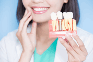 Woman tapping her chin and holding a dental implant model 